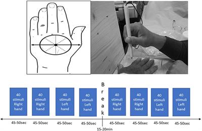 Reliability of Upper Limb Pin-Prick Stimulation With Electroencephalography: Evoked Potentials, Spectra and Source Localization